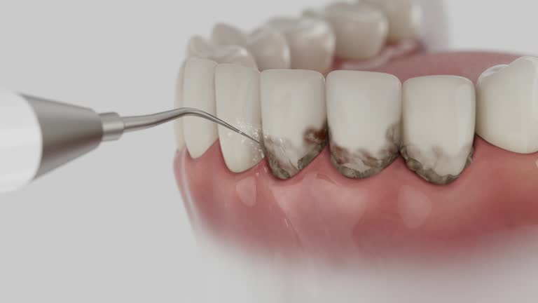Reliable Dental contractor in Drain, OR by Smile Center Dentistry